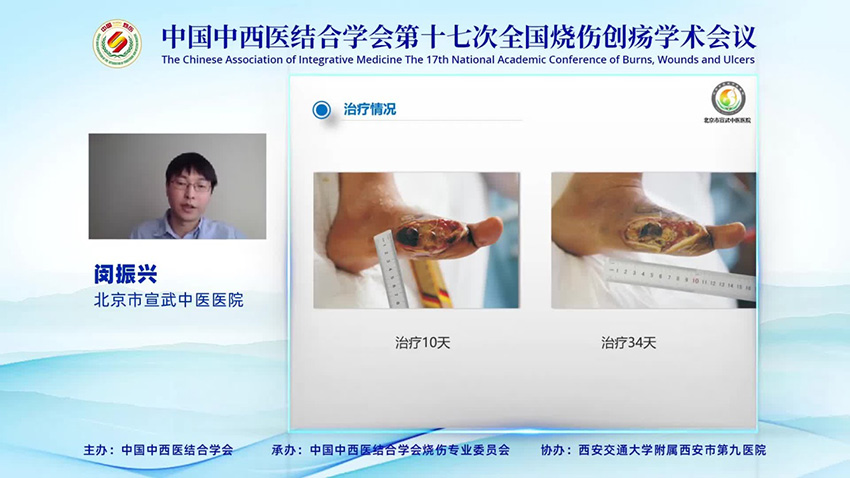 zoty中欧·(中国有限公司)官方网站