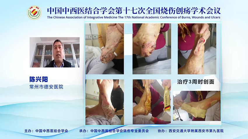 zoty中欧·(中国有限公司)官方网站